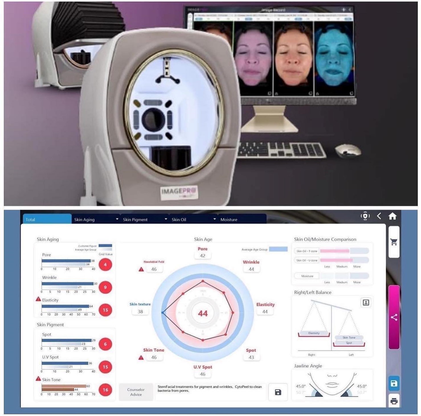 Skin Analysis – Your Endless Transformation